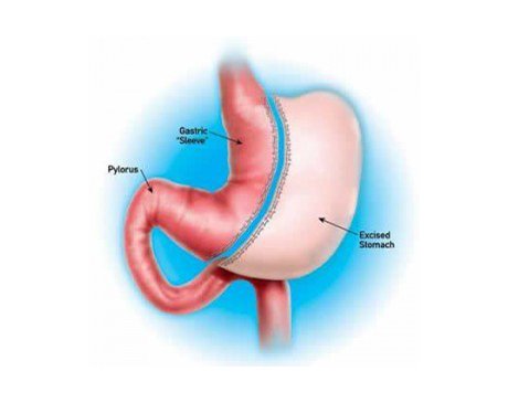 Kidney