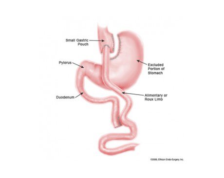 Kidney+intestine