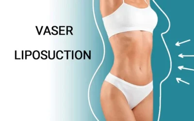 Step-by-Step Process of Vaser Liposuction: Before, During, and After