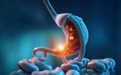 Essential Facts to Know Before Choosing a SADI Revision Surgeon