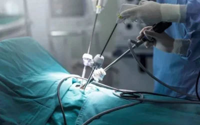 Understanding Minimally Invasive General Surgery Techniques and Benefits