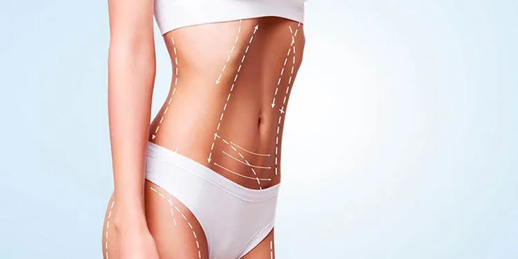 vaser-lipo vaser liposuction NJ